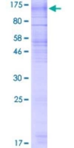 Novus Biologicals Recombinant Human RNF139 GST (N-Term) Protein 10 &mu;g | Buy Online | Novus Biologicals&trade; | Fisher Scientific
