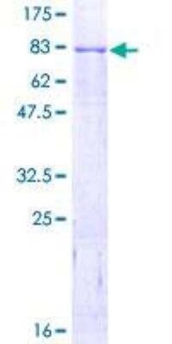 Novus Biologicals Recombinant Human ROR alpha/NR1F1 GST (N-Term) Protein 2 &mu;g | Buy Online | Novus Biologicals&trade; | Fisher Scientific
