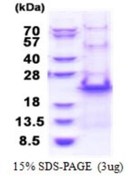 Novus Biologicals&trade;&nbsp;Recombinant Human RPS20 His Protein