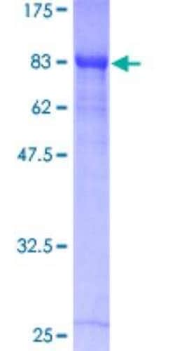 Novus Biologicals&trade;&nbsp;Recombinant Human RUNX1T1/ETO GST (N-Term) Protein