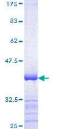Novus Biologicals Recombinant Human RUNX1T1/ETO GST (N-Term) Protein 25 &mu;g | Buy Online | Novus Biologicals&trade; | Fisher Scientific