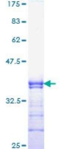 Novus Biologicals Recombinant Human RUNX2/CBFA1 GST (N-Term) Protein 25 &mu;g | Buy Online | Novus Biologicals&trade; | Fisher Scientific