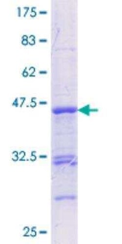Novus Biologicals Recombinant Human RUNX2/CBFA1 GST (N-Term) Protein 25 &mu;g | Buy Online | Novus Biologicals&trade; | Fisher Scientific