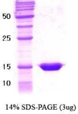 Novus Biologicals&trade;&nbsp;Recombinant Human RXR alpha/NR2B1 Protein