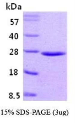 Novus Biologicals Recombinant Human Rab5a Protein 0.1mg; Unlabeled | Buy Online | Novus Biologicals&trade; | Fisher Scientific