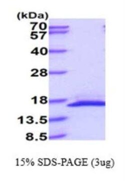 Novus Biologicals Recombinant Human Reg4 His Protein 100 &mu;g | Buy Online | Novus Biologicals&trade; | Fisher Scientific