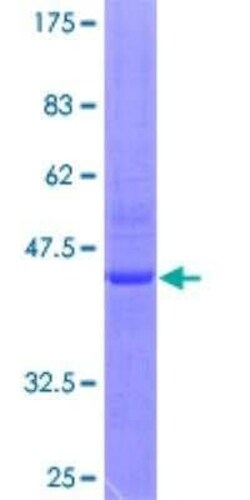 Novus Biologicals Recombinant Human RhoH GST (N-Term) Protein 2 &mu;g | Buy Online | Novus Biologicals&trade; | Fisher Scientific