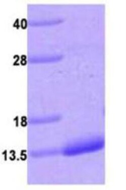 Novus Biologicals&trade;&nbsp;Recombinant Human S100A4 His Protein