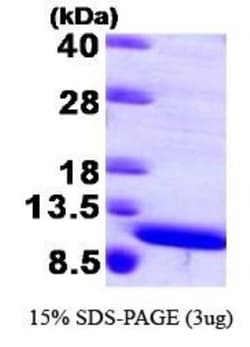 Novus Biologicals&trade;&nbsp;Recombinant Human S100A8 Protein