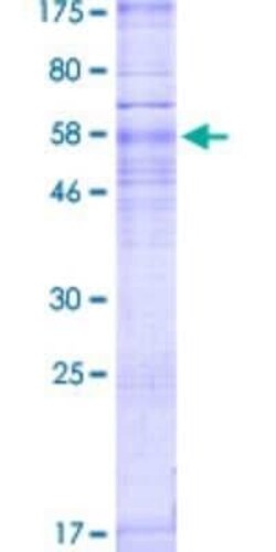 Novus Biologicals Recombinant Human S1P3/EDG-3 GST (N-Term) Protein 2 &mu;g | Buy Online | Novus Biologicals&trade; | Fisher Scientific