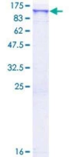 Novus Biologicals Recombinant Human SCYL2 GST (N-Term) Protein 10 &mu;g | Buy Online | Novus Biologicals&trade; | Fisher Scientific