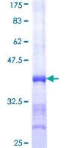 Novus Biologicals Recombinant Human SERCA1 ATPase GST (N-Term) Protein 10 &mu;g | Buy Online | Novus Biologicals&trade; | Fisher Scientific