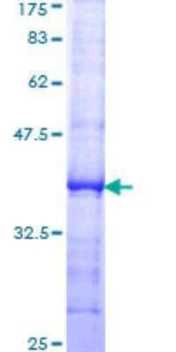 Novus Biologicals Recombinant Human SERCA3 ATPase GST (N-Term) Protein 25 &mu;g | Buy Online | Novus Biologicals&trade; | Fisher Scientific