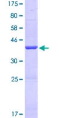 Novus Biologicals Recombinant Human SERHL GST (N-Term) Protein 25 &mu;g | Buy Online | Novus Biologicals&trade; | Fisher Scientific