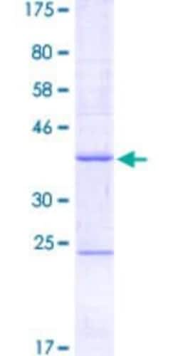 Novus Biologicals Recombinant Human SETDB2 GST (N-Term) Protein 25 &mu;g | Buy Online | Novus Biologicals&trade; | Fisher Scientific