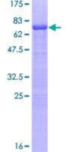 Novus Biologicals Recombinant Human SF-1/NR5A1/Steroidogenic Factor 1 GST (N-Term) Protein 25 &mu;g | Buy Online | Novus Biologicals&trade; | Fisher Scientific