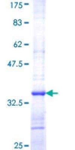 Novus Biologicals Recombinant Human SLC25A6 GST (N-Term) Protein 10 &mu;g | Buy Online | Novus Biologicals&trade; | Fisher Scientific