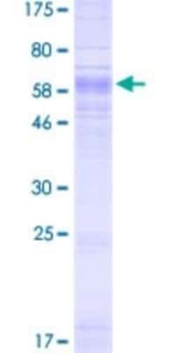 Novus Biologicals Recombinant Human SLC37A4 GST (N-Term) Protein 2 &mu;g | Buy Online | Novus Biologicals&trade; | Fisher Scientific