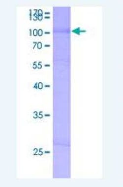 Novus Biologicals Recombinant Human SLC6A4/5-HTTLPR/Serotonin transporter GST (N-Term) Protein 2 &mu;g | Buy Online | Novus Biologicals&trade; | Fisher Scientific