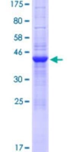 Novus Biologicals&trade;&nbsp;Recombinant Human SLX1A GST (N-Term) Protein