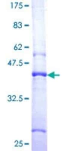 Novus Biologicals Recombinant Human SMA4 GST (N-Term) Protein 10 &mu;g | Buy Online | Novus Biologicals&trade; | Fisher Scientific