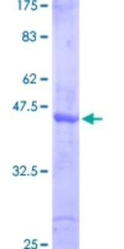 Novus Biologicals Recombinant Human SMAD6 GST (N-Term) Protein 25 &mu;g | Buy Online | Novus Biologicals&trade; | Fisher Scientific