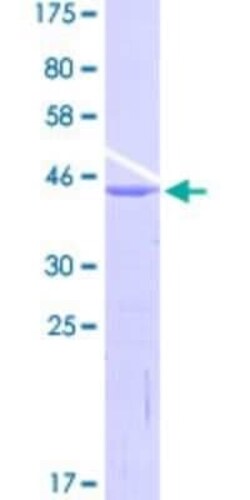 Novus Biologicals Recombinant Human SNAPC4 GST (N-Term) Protein 25 &mu;g | Buy Online | Novus Biologicals&trade; | Fisher Scientific