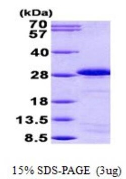 Novus Biologicals&trade;&nbsp;Recombinant Human SP17 His Protein