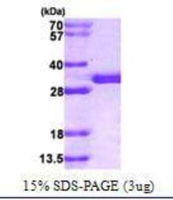 Novus Biologicals Recombinant Human SPR His Protein 100 &mu;g | Buy Online | Novus Biologicals&trade; | Fisher Scientific