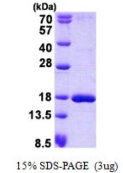 Novus Biologicals&trade;&nbsp;Recombinant Human SSBP1 His Protein