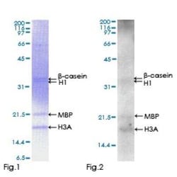 Novus Biologicals Recombinant Human STK22C GST (N-Term) Protein 25 &mu;g | Buy Online | Novus Biologicals&trade; | Fisher Scientific