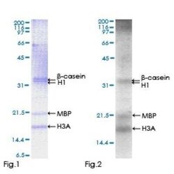 Novus Biologicals Recombinant Human STK25 GST (N-Term) Protein 2 &mu;g | Buy Online | Novus Biologicals&trade; | Fisher Scientific
