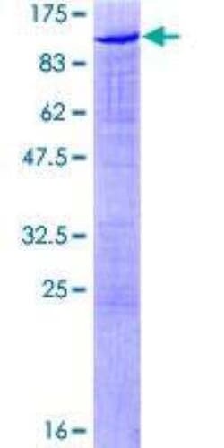 Novus Biologicals Recombinant Human Scaffold attachment factor B2 GST (N-Term)