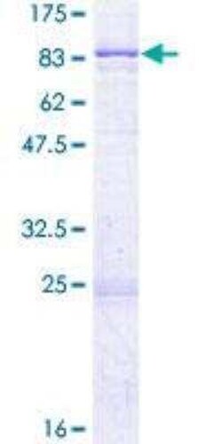Novus Biologicals Recombinant Human Serine Palmitoyltransferase 2 GST (N-Term) Protein 2 &mu;g | Buy Online | Novus Biologicals&trade; | Fisher Scientific