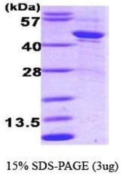 Novus Biologicals&trade;&nbsp;Recombinant Human Serpin A1/alpha 1-Antitrypsin Protein