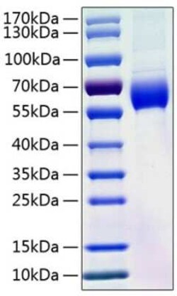 Novus Biologicals Recombinant Human Serpin A8/Angiotensinogen His (C-Term) Protein 100 &mu;g | Buy Online | Novus Biologicals&trade; | Fisher Scientific