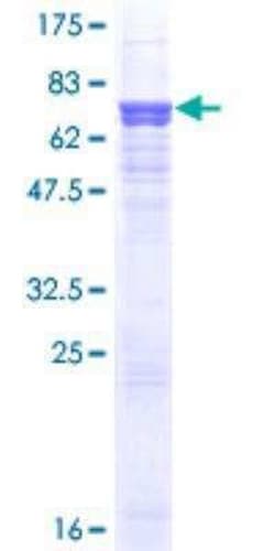 Novus Biologicals Recombinant Human Serpin A8/Angiotensinogen GST (N-Term) Protein 25 &mu;g | Buy Online | Novus Biologicals&trade; | Fisher Scientific