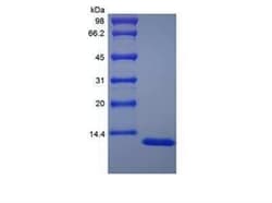 Novus Biologicals Recombinant Human Serum Amyloid A1 Protein 1 mg | Buy Online | Novus Biologicals&trade; | Fisher Scientific