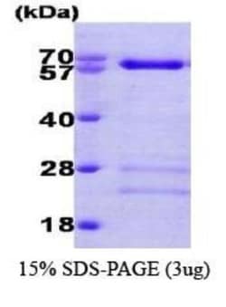 Novus Biologicals&trade;&nbsp;Recombinant Human Smad4 His Protein