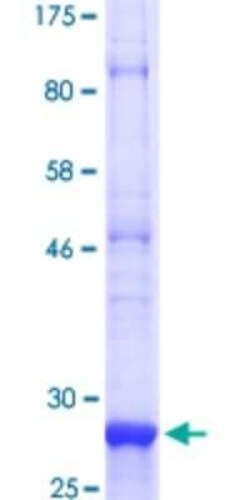 Novus Biologicals Recombinant Human Smoothened GST (N-Term) Protein 10 &mu;g | Buy Online | Novus Biologicals&trade; | Fisher Scientific