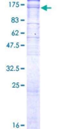Novus Biologicals Recombinant Human Sodium Potassium ATPase Alpha 3 GST (N-Term) Protein 2 &mu;g | Buy Online | Novus Biologicals&trade; | Fisher Scientific