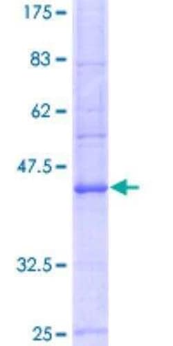 Novus Biologicals Recombinant Human Sodium Potassium ATPase Alpha 3 GST (N-Term) Protein 10 &mu;g | Buy Online | Novus Biologicals&trade; | Fisher Scientific