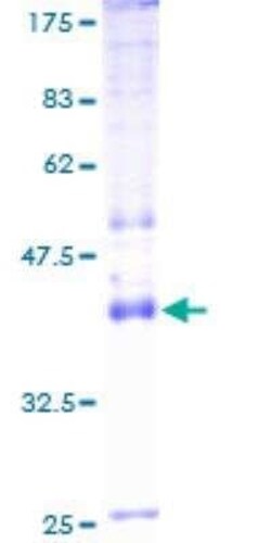 Novus Biologicals Recombinant Human Sodium Potassium ATPase Alpha 4 GST (N-Term) Protein 2 &mu;g | Buy Online | Novus Biologicals&trade; | Fisher Scientific