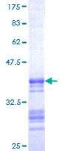 Novus Biologicals Recombinant Human Somatostatin GST (N-Term) Protein 10 &mu;g | Buy Online | Novus Biologicals&trade; | Fisher Scientific