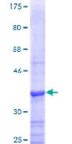 Novus Biologicals Recombinant Human Steroid sulfatase GST (N-Term) Protein 25 &mu;g | Buy Online | Novus Biologicals&trade; | Fisher Scientific