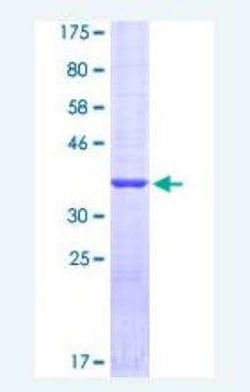 Novus Biologicals Recombinant Human Surfactant Protein A GST (N-Term) Protein 25 &mu;g | Buy Online | Novus Biologicals&trade; | Fisher Scientific