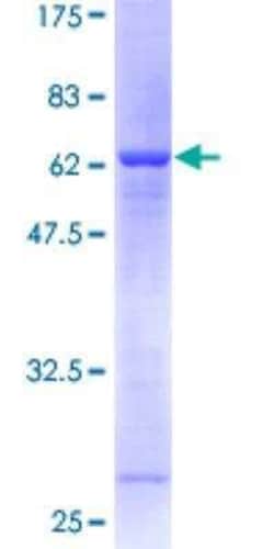 Novus Biologicals Recombinant Human Syntaxin 5 GST (N-Term) Protein 10 &mu;g | Buy Online | Novus Biologicals&trade; | Fisher Scientific