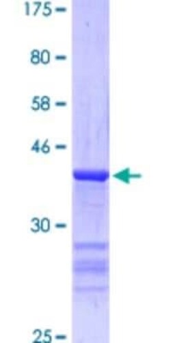 Novus Biologicals Recombinant Human T-bet/TBX21 GST (N-Term) Protein 25 &mu;g | Buy Online | Novus Biologicals&trade; | Fisher Scientific