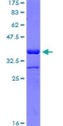 Novus Biologicals Recombinant Human T-bet/TBX21 GST (N-Term) Protein 25 &mu;g | Buy Online | Novus Biologicals&trade; | Fisher Scientific