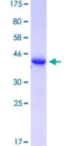 Novus Biologicals Recombinant Human TCR V delta GST (N-Term) Protein 10 &mu;g | Buy Online | Novus Biologicals&trade; | Fisher Scientific